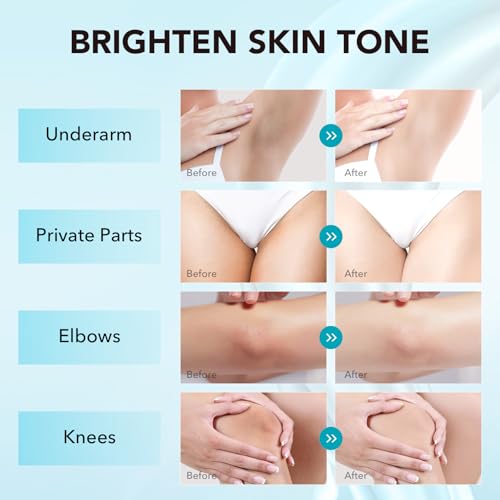 Skin Bleaching Cream for Dark Spots & Uneven Tone - 1.7 fl oz