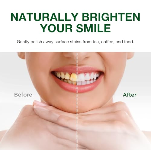 Sri Sri Tattva Sudanta Herbal Toothpaste | SLS & Fluoride Free | 200g Pack of 3
