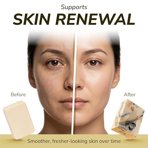 SEMKO Facial Cleansing Bar – Deep Pore Cleanser for Radiant Smooth Skin 135g