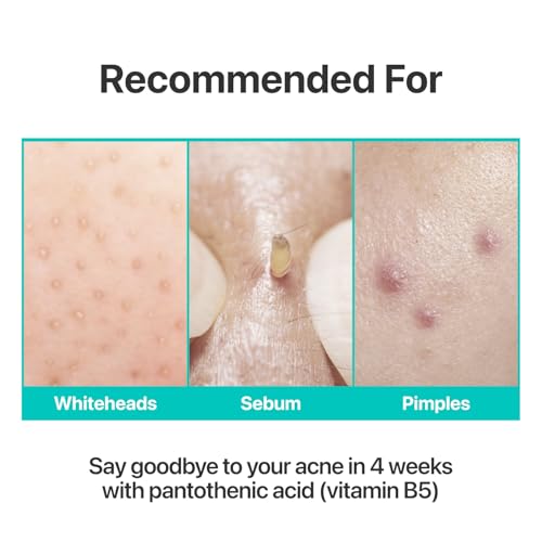 Numbuzin No.1 Pantothenic B5 Skin Soothing Cream for Sebum Control & Skin Troubles