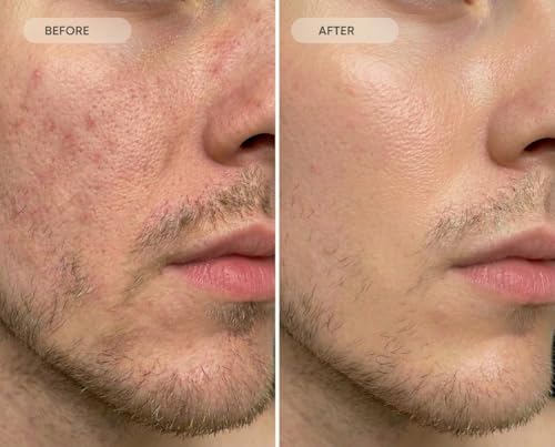 Original Glow Skincare Reset Face Cleanser 100ml – Gentle Pre & Postbiotic Face Wash for Sensitive Skin & Acne-Prone Skin