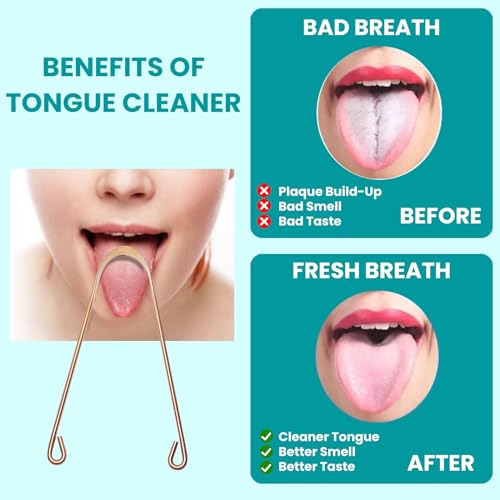 2-Piece Copper & Stainless Steel Tongue Scraper Set for Fresh Breath