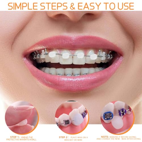 30 Pack Colorful Orthodontic Wax for Braces - Safe Dental Care