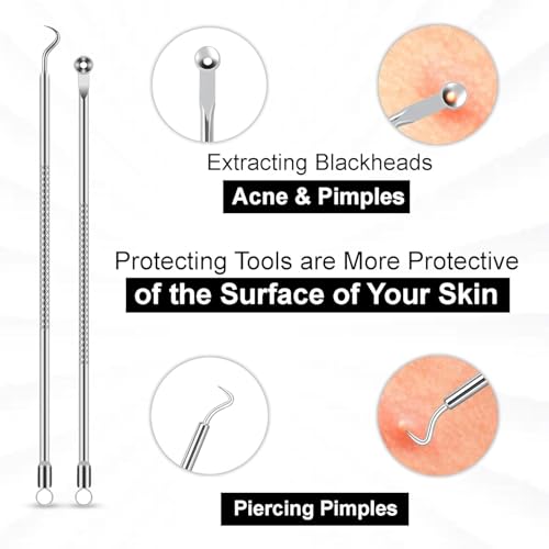 Professional Stainless Steel Blackhead Remover Kit for Acne & Blemish Care