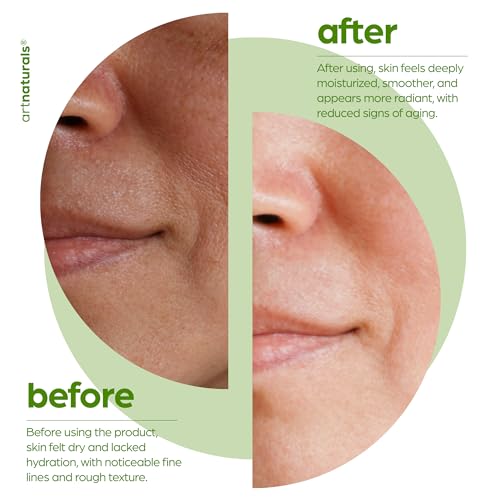 Artnaturals Squalane Facial Oil - Hydrating & Fast Absorbing 1 oz