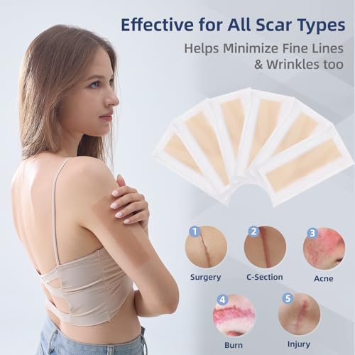 Light Tone Silicone Scar Sheets - 6 Reusable Strips, 1.6" x 6"