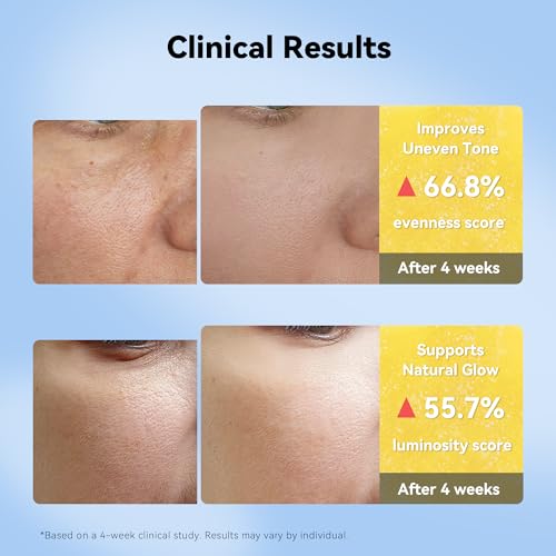 XIANUI Vitamin C Niacinamide Brightening Face Serum - Hydrating & Glow