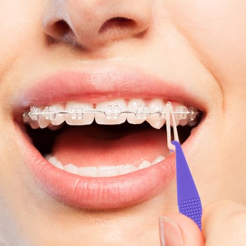 30 Pcs Disposable Rubber Bands Placers for Braces - Multicolored