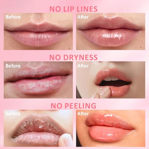 DMSKY 6-Pack Honey Pot Lip Balm Set with 6 Flavors - Lip Mask & Nourishing Lip Care