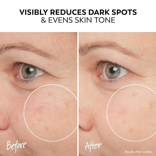 Olay Pro-X Even Skin Tone Spot Fading Treatment Serum - 1.3 oz