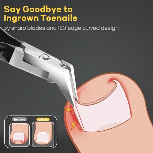 Wanmat Upgraded Toenail Clipper with Catcher | Heavy Duty Thick & Ingrown Nail Cutter for Men & Seniors