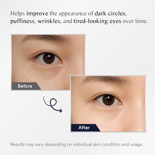 Under Eye Patches for Dark Circles - 30 Pairs Gel Masks with Collagen & Retinol