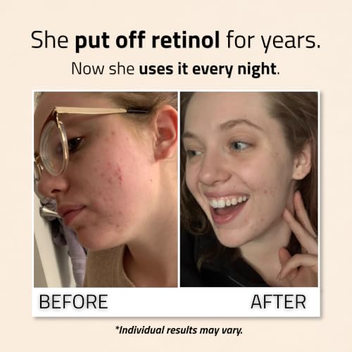 YEOUTH Retinol Serum for Face 1oz with Hyaluronic Acid & Vitamin E - Gentle Night Anti-Aging