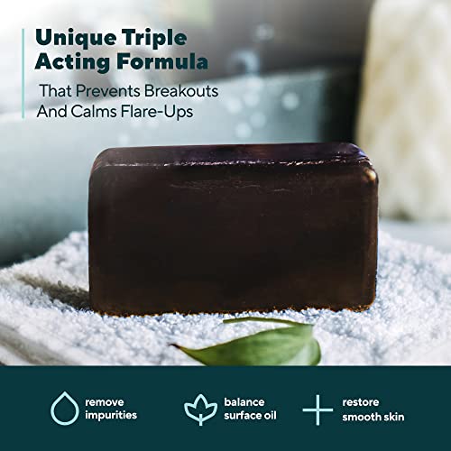 Marie Originals Acne Bar Soap with Bentonite Clay & Oat Bran