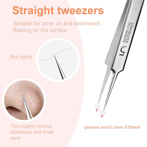 Blackhead Remover Tweezers Kit - 3 Precision Tools for Acne & Ingrown Hair