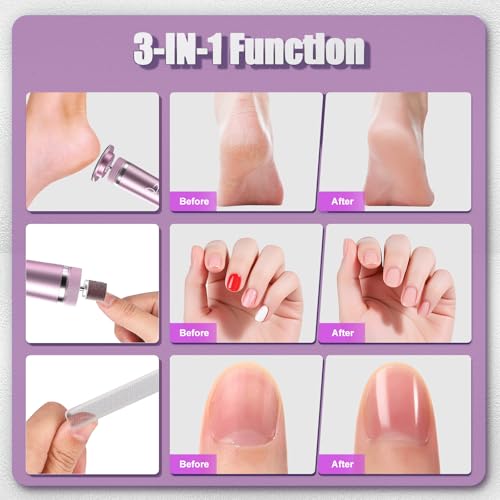 Electric Callus Remover for Feet - Pink, Rechargeable, Dual Grinding Heads