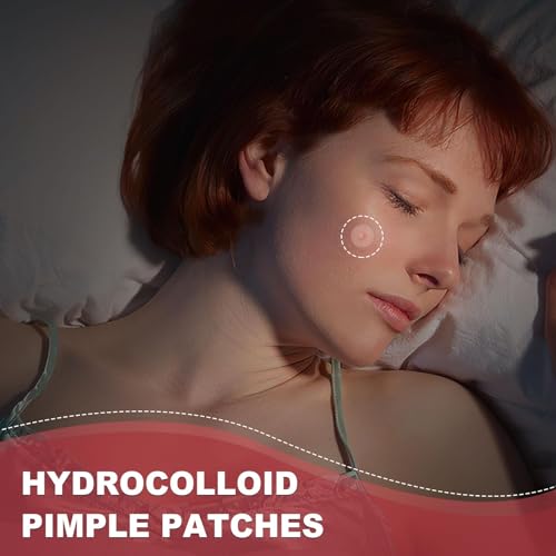 Hydrocolloid Acne Patches for Spot Treatment - 432 Count