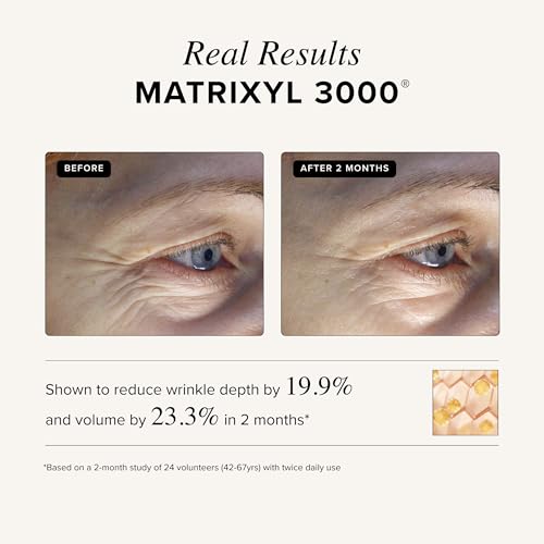 Asterwood Triple Repair Peptide Cream 1.7 Fl Oz | Anti-Aging & Hydrating