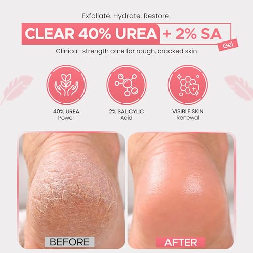 CLEAR Urea Gel 40% Plus 2% Salicylic Acid - 4oz Exfoliating Foot Treatment