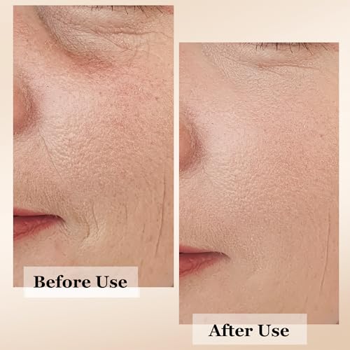 mivida 4-in-1 Anti-Aging Face Serum with Retinol, Vitamin C & Hyaluronic Acid