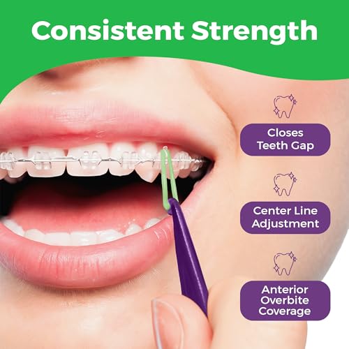 5/16 Inch Orthodontic Rubber Bands for Braces - 100 Pack