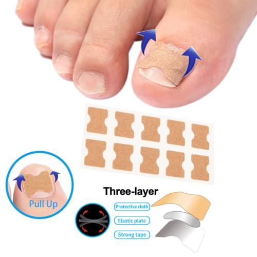 Ingrown Toenail Correction Kit with Nail Clippers & Care Gel - Foot Care Tools