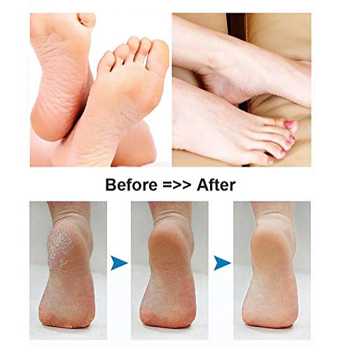 BOMPOW Electric Foot Callus Remover Blue Rechargeable Pedicure Tool with 2 Roller Heads