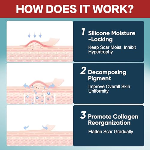 Silicone Scar Tape Roll 1.6x240 Inches for Scar Removal & Keloid Treatment