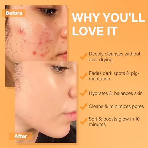 Facial Clay Mask Set - Vitamin C, Dead Sea Mud & Salicylic Acid Masks