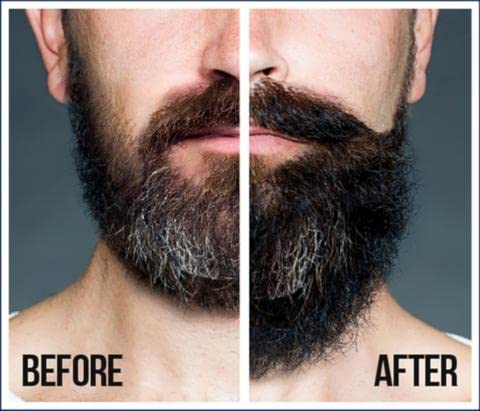 SFC Natural King Pro-Growth Beard & Hair Oil with Jamaican Black Castor Oil 7.1 oz