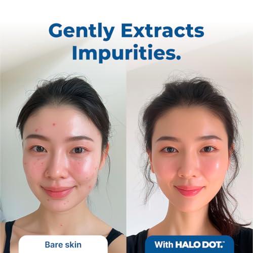 Halo Dot Ultra Thin Hydrocolloid Pimple Patches - Invisible Acne Treatment