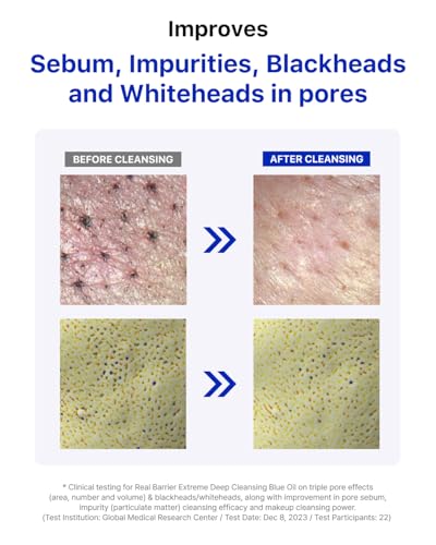 Deep Cleansing Facial Oil for Sensitive Skin - Removes Makeup & Blackheads - Hydrating, Gentle Face Oil - 200ml