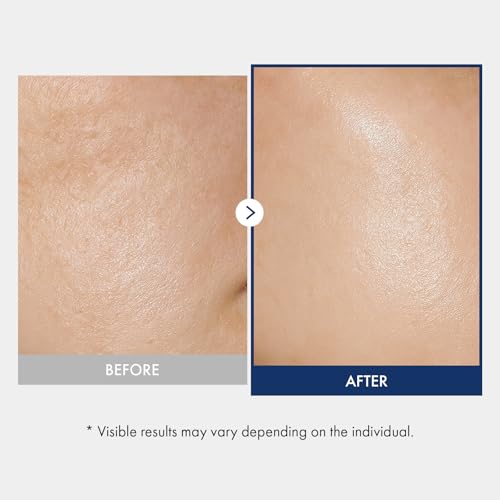 TOSOWOONG Ceramide Barrier Serum for Hydrating & Soothing Skin, Sensitive Skin Care