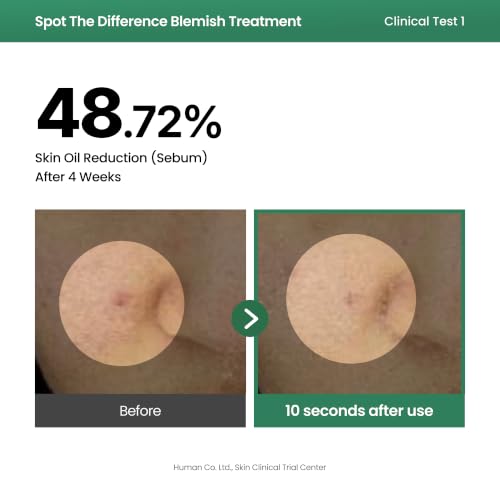 AXIS-Y Blemish Spot Treatment with 2% Niacinamide & AHA/BHA