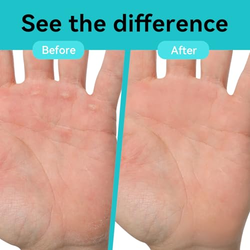 Double-Sided Hand and Finger File for Rock Climbers - Smooths Rips & Cracks