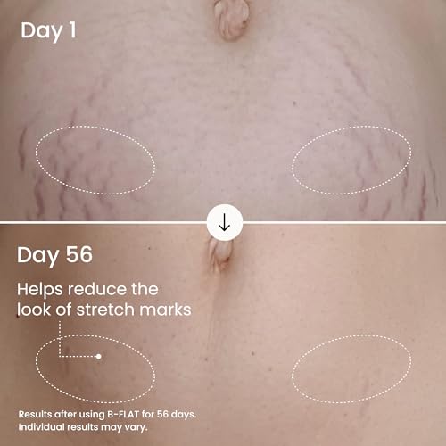 MA?LYS B-FLAT Belly Firming Cream for Women - Skin Tightening & Moisturizing Treatment with Shea Butter & Bentonite Clay - Smooths Look of Stretch Marks - Postpartum Body Care (2 Pack)