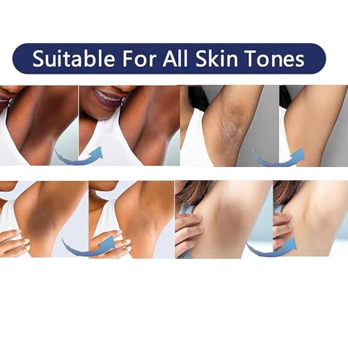 SMILEFACE Skin Lightening Cream for Private Parts, Underarms & Dark Spots