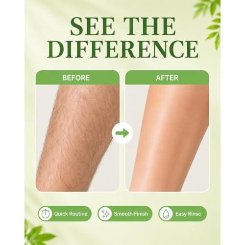 Hair Removal Cream for Women, 6.76 Fl Oz Gentle Depilatory Cream for Legs, Arms, Underarms, Bikini Line, Fast Body Hair Remover with Smooth Skin Finish, Sensitive Skin Care