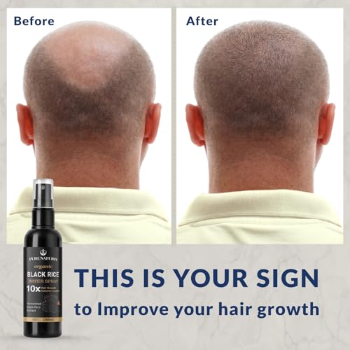 PureNaturis Castor Oil Ginger Rice Water Hair Growth Serum - Leave-In Spray for Thicker, Fuller Hair - 3.5 fl oz
