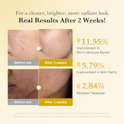 Medicube Kojic Acid & Turmeric Serum for Troubled Skin