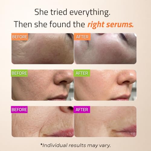 GLEOW Skincare Set with Retinol, Vitamin C & Hyaluronic Acid Serum - Combo Pack 1oz