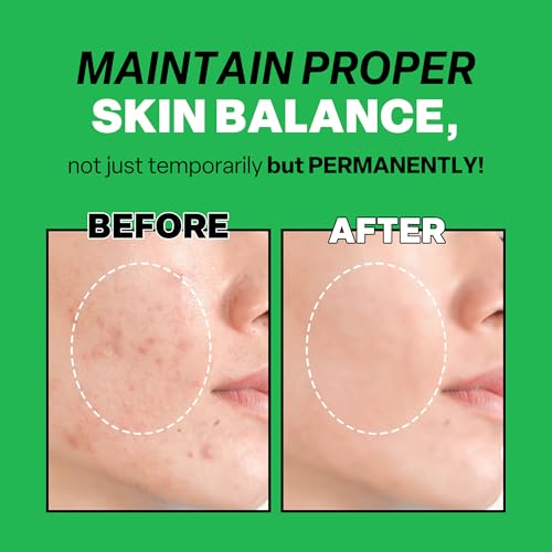 Troubless Clear Toner Face Pads - Gentle Peeling & Hydrating Tea Tree, 60 Pads