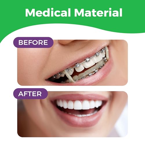 5/16 Inch Orthodontic Rubber Bands for Braces - 100 Pack