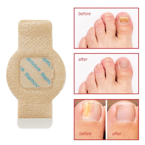 Toenail Care Patches for Discolored Nails, 21 Count Self-Adhesive Strips