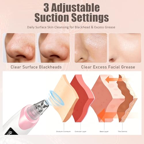 Gackoko Blackhead Remover Pore Vacuum with 5 Suction Probes - Pink