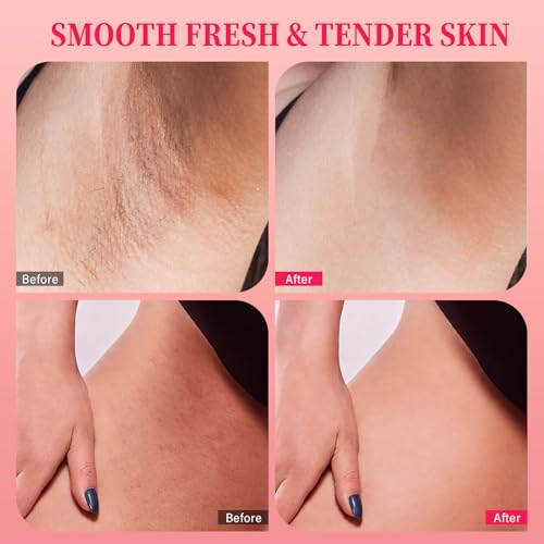 Bikini Area Exfoliator Scrub with 10% AHA/BHA & Vitamin C - 7.76 oz