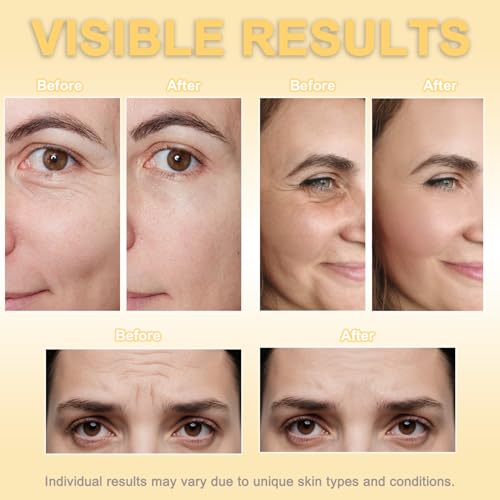 Pink Japanese Face Tape for Wrinkles Overnight Anti-Aging Skin Lift, Hypoallergenic