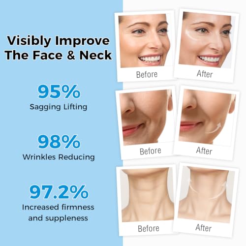 OUKEYA 3% Retinol Cream for Face and Neck - Anti-Aging Moisturizer