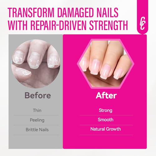 CHUCHU 15ml Nail Strengthener & Growth Treatment - 8-in-1 Clear Nail Hardener & Ridge Filler for Damaged Nails