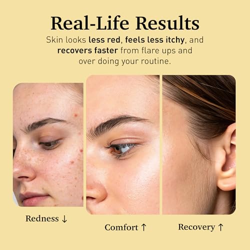 Hypochlorous Acid Face Spray for Sensitive Skin - Soothing Skin Relief Mist